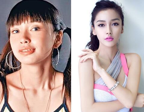 为什么明星要整容,追求完美与自我认同的探索